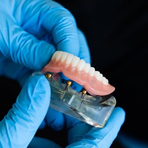 due mani con guanti che maneggiano una dentiera